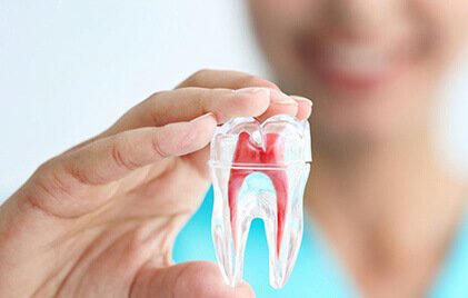 root canal treatment Shela, Ahmedabad